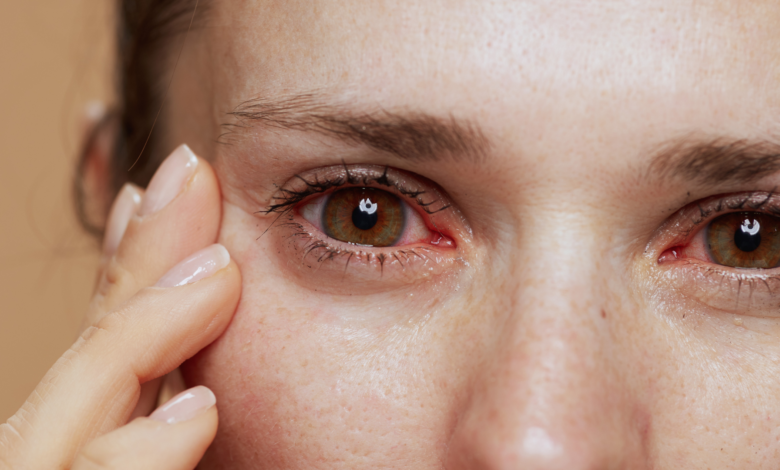 7 Cara Mencegah dan Mengatasi Penyakit Mata Katarak